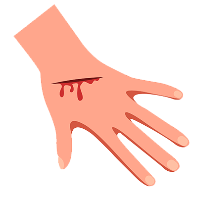 CBD Rescue Body Balm