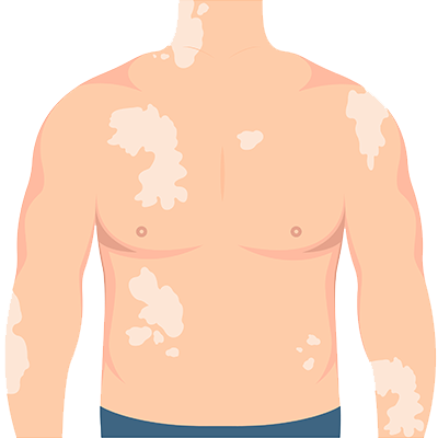 CBD Rescue Body Balm